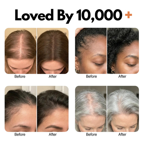 Koreas #1 Hair Growth Serum